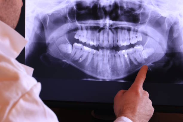 Best Holiday Emergency Dentist in Heritage Lake, IN