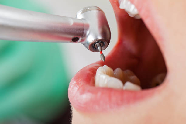 Best Weekend Emergency Dentist in Heritage Lake, IN